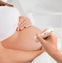 Wellue Baby Fetal Monitor thumbnail